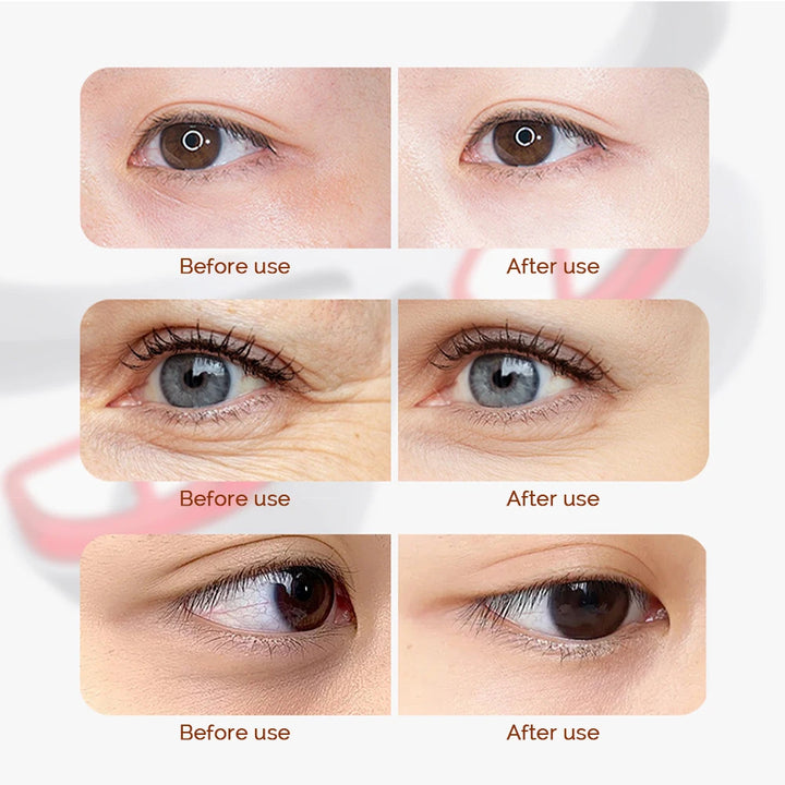 VisionEase™ Kabelloses Augenmassagegerät